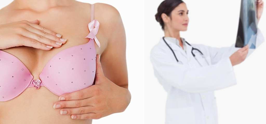 Лампэктомия – щадящий метод лечения рака груди